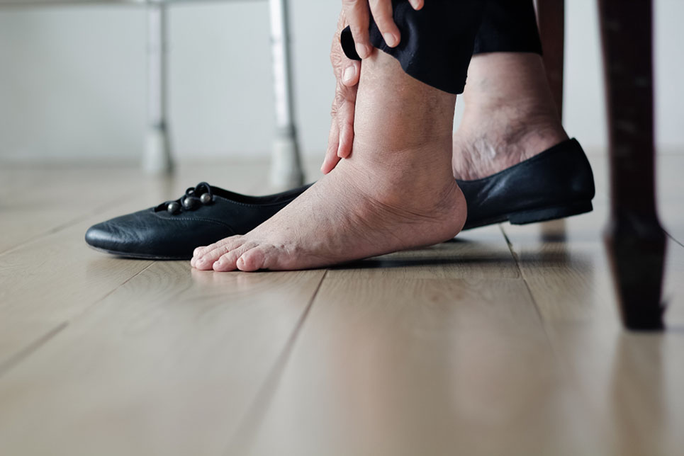 اسباب انتفاخ القدمين عند كبار السن